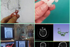 3D-хирургия головного мозга
